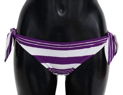 Braguita de bikini elegante a rayas: glamour sin esfuerzo junto a la piscina